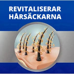 6x Kirkland Signature Minoxidil-lösning 5% för män